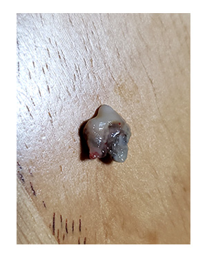 犬 チワワ 心臓病 保護犬 レスキュー ほご 捨て 多頭 抜 歯 歯槽 歯茎 歯周病 保健所 老犬 福 吠 シニア ペット 心臓 犬 イラスト 絵 まんが 漫画 マンガ