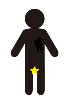 scrotum