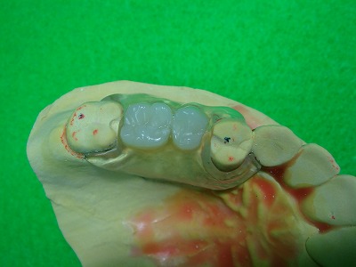 ノンクラ2011