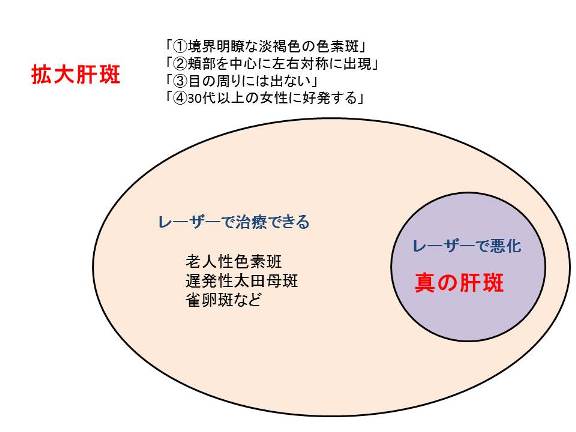¥À¥Ö¥ë¥¹¥¿¥ó¥À¡¼¥É