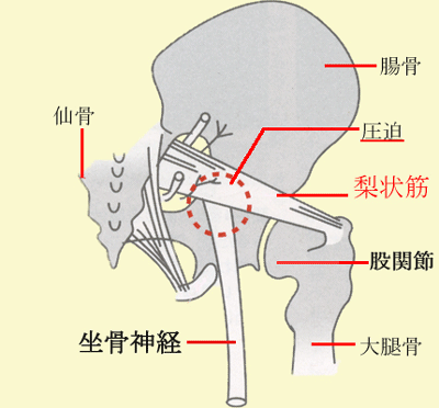 坐骨神経