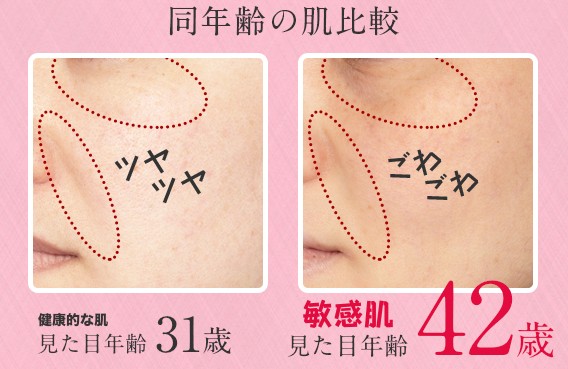 年齢よりも老け顔に見せる糖化と負の連鎖とは アヤナスで敏感肌のくすみ ほうれい線を解消