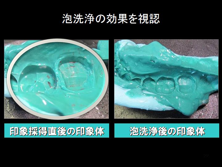 確実に入れ歯の血液が分解されている2