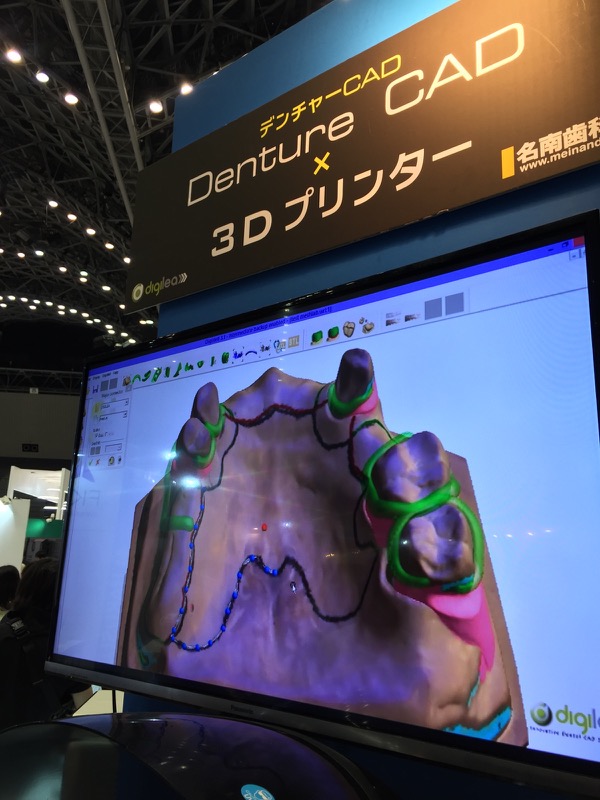 レポート 歯科技工かごしま