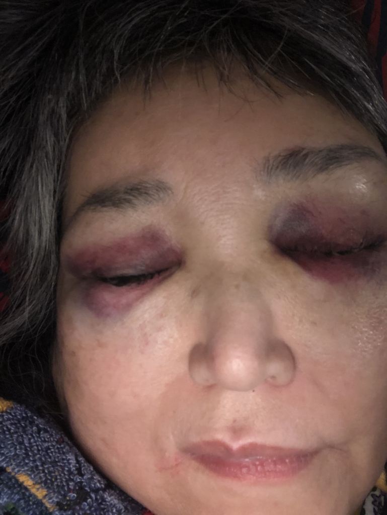 ますますすごい顔 Aterier Noriko アトリエ ノリコ オーナーブログ