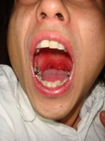 nodo