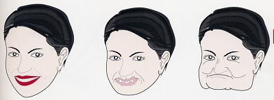 歯がなくなると