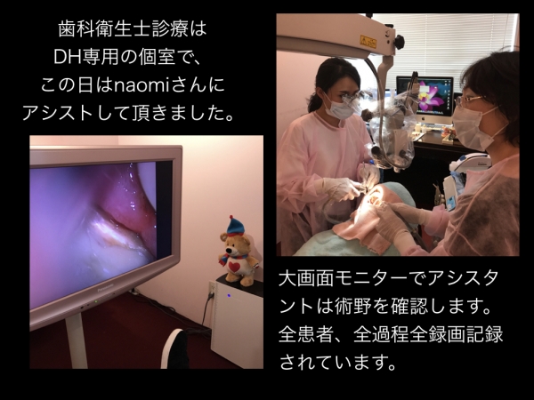 顕微鏡歯科衛生士