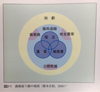 人気特価をすべて 根面う蝕の予防処置と治療方針 東京歯科大学社会歯科学研究室 語学+参考書