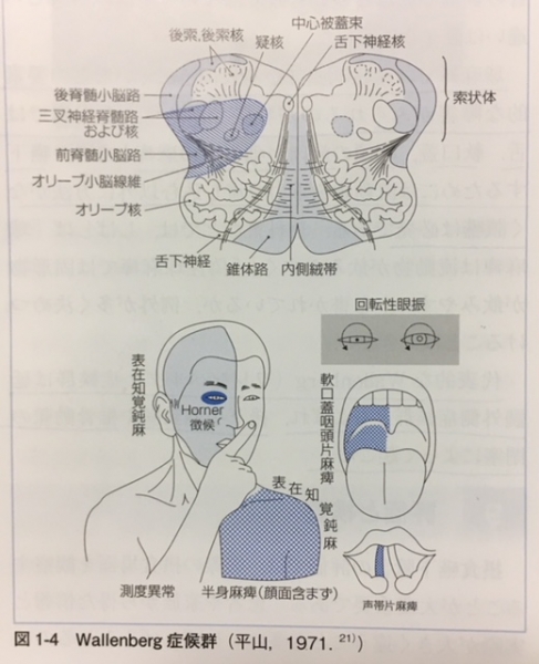 Logemann摂食・嚥下障害 Logemann 摂食・嚥下障害/医歯薬出版株式会社