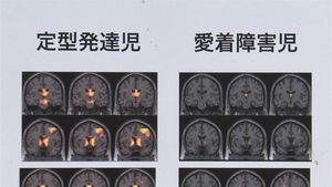 愛着2