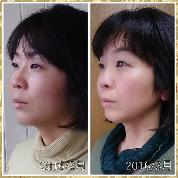 写真コラージュメーカー_97MMG4(1).png