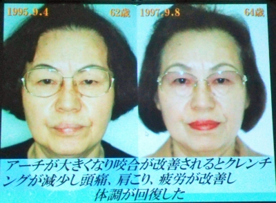 ¥¢¥ó¥Á¥¨¥¤¥¸¥ó¥°