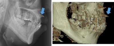 X-rays