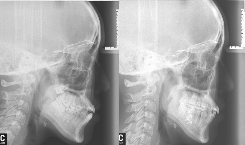 C/B&A