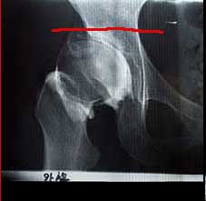 ¥-¥￠¥???￠V??~????class=