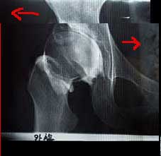 ¥-¥￠¥??§Z?a¨?1?糖