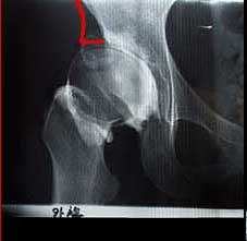 ?3/4累V??~?°?餤?《????￠??class=