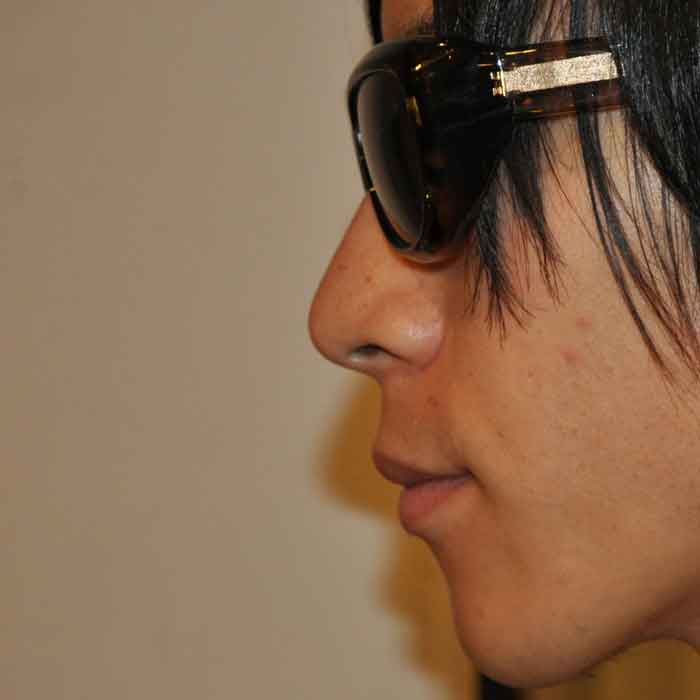 husam el odeh×MIHARAYASUHIRO FLOATING EYE サングラス BLACK/BLACK