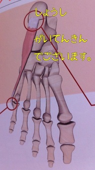 小趾外転筋