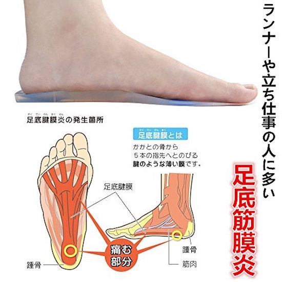 足底腱膜炎