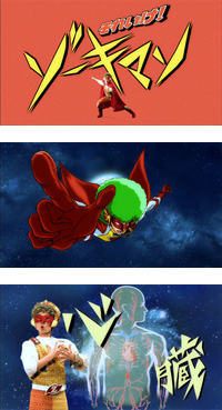 ゾーキマン