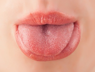 先端 痛い 舌