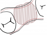 図3