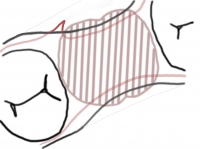 図4