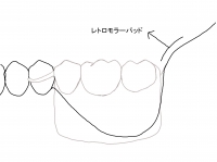 問題ある吸収