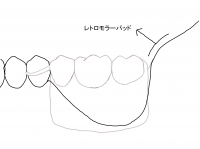 問題ある吸収