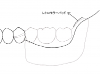 理想的な吸収