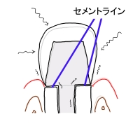 図3