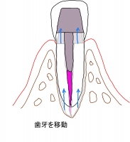 図4