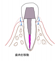 図5