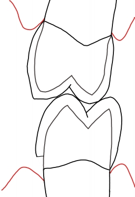 WSD