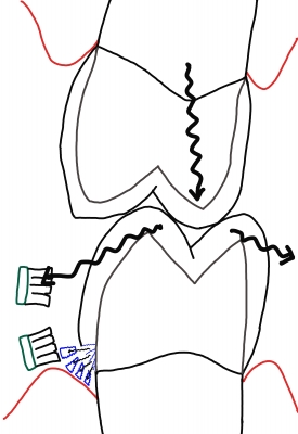 歯ブラシ