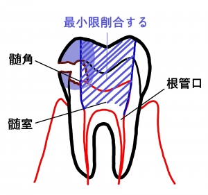 注抜