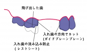 マウスプレパレーション