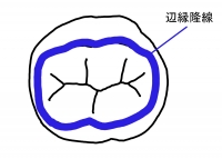 辺縁隆線