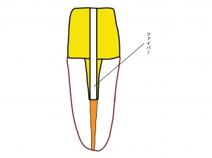ファイバーコア
