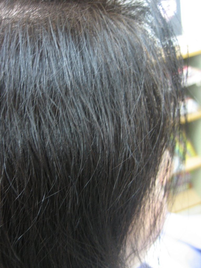 美容室で起きた髪のダメージ　髪の毛が痛んだ時に考えること髪質改善専門店