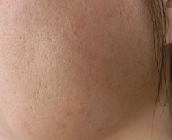 肌断食実践ちう 自分のことなら棚の上