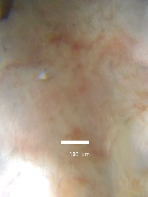 西瓜の実　拡大