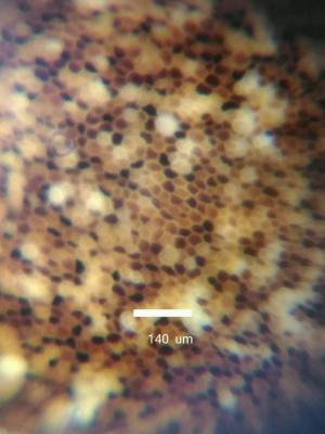 西瓜の種　拡大１