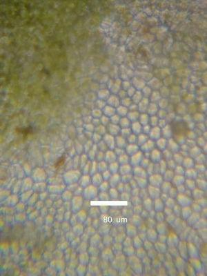 西瓜の皮　拡大２