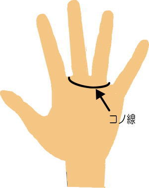 コノ線
