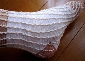 ギプス