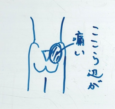 腰痛
