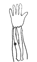 肩1
